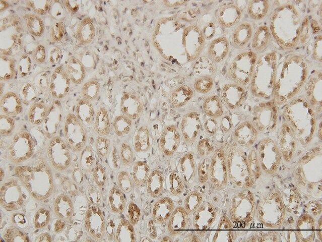 Monoclonal Anti-EXOSC3 antibody produced in mouse