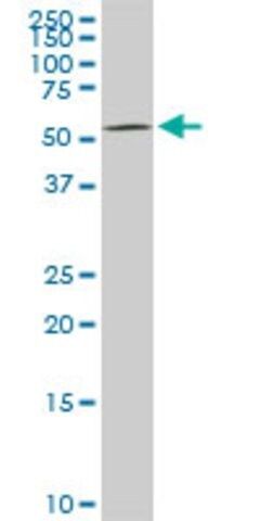 Monoclonal Anti-DGKE antibody produced in mouse