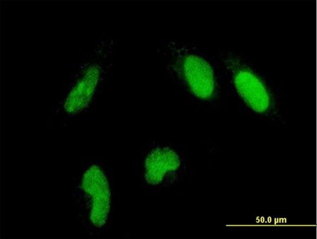 Monoclonal Anti-GLTSCR2 antibody produced in mouse