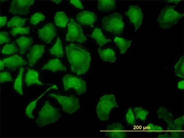 Monoclonal Anti-TROVE2 antibody produced in mouse