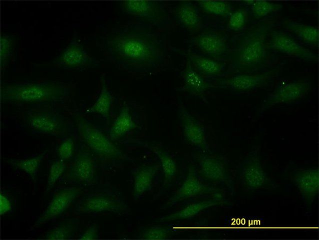 Monoclonal Anti-SUGT1 antibody produced in mouse