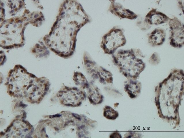 Monoclonal Anti-EGR1 antibody produced in mouse