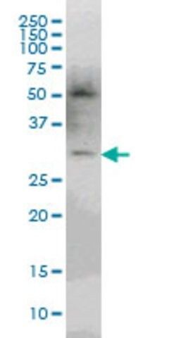 Monoclonal Anti-pp9099 antibody produced in mouse