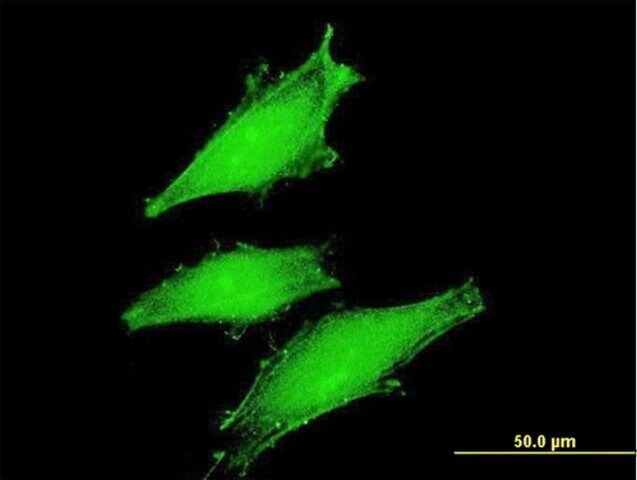 Monoclonal Anti-FBXW11 antibody produced in mouse