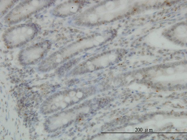 Monoclonal Anti-PRKG1 antibody produced in mouse