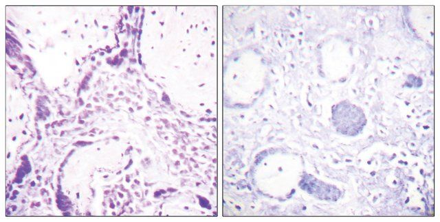 Anti-PPAR- antibody produced in rabbit