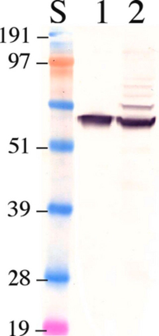 Anti-Retinal Pigment Epithelium 65 Antibody