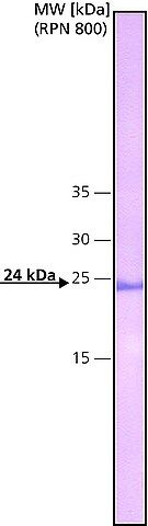 Monoclonal Anti-C-Reactive Protein antibody produced in mouse