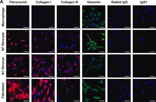 Anti-Fibronectin antibody produced in rabbit