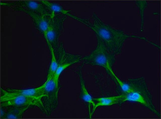 Anti-Myosin IIA, non muscle antibody produced in rabbit