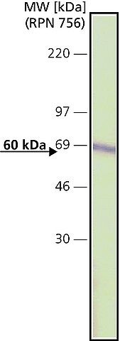 Anti-Catalase antibody ,Mouse monoclonal