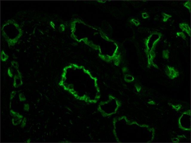 Anti-CD31(PECAM-1) antibody , Mouse monoclonal