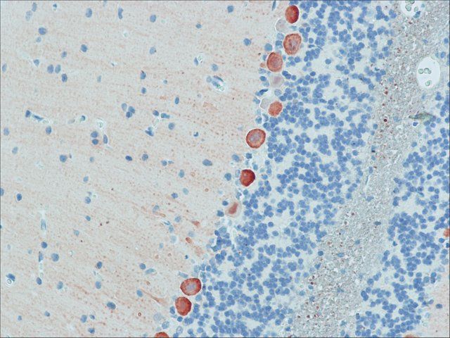 Anti-Myosin Va (LF-18) antibody produced in rabbit