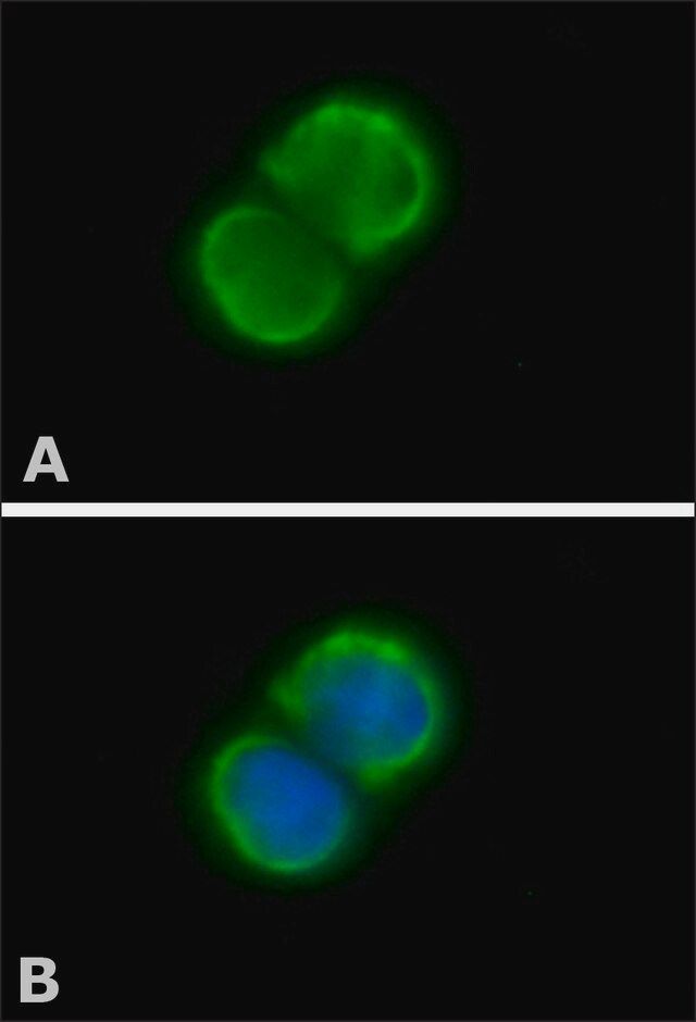 Anti-PARP antibody produced in rabbit