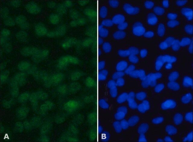 Anti-MSK-1 antibody produced in rabbit