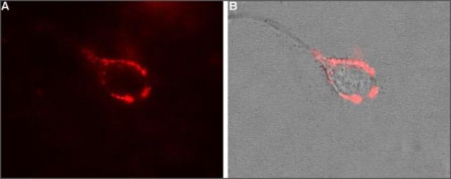 Anti-Calcium Channel (<sub>2</sub>/-1 Subunit) antibody produced in rabbit