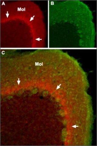 Anti-Sodium Channel, Brain Type I ( subunit) antibody produced in rabbit