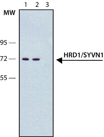 Anti-HRD1/SYVN1 antibody, Mouse monoclonal