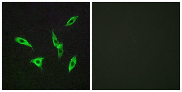 Anti-ADORA2B antibody produced in rabbit