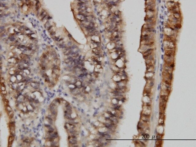 Monoclonal Anti-S100A6 antibody produced in mouse