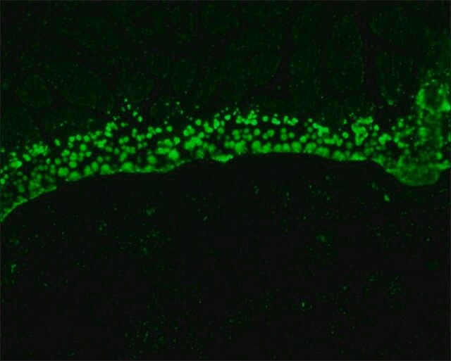 Monoclonal Anti-S100A6 antibody produced in mouse