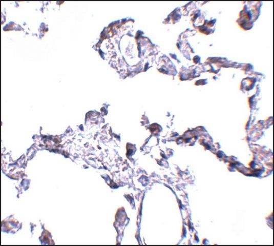 Anti-CD81 antibody produced in rabbit