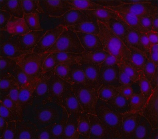 Anti--Catenin-Cy3 antibody, Mouse monoclonal