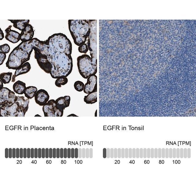 Anti-EGFR antibody produced in rabbit