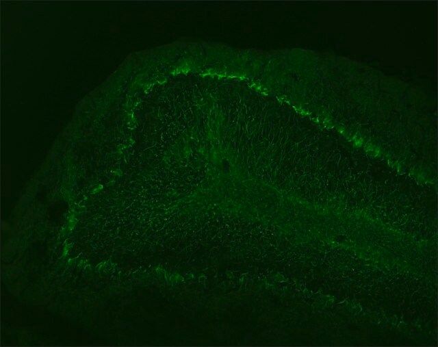 Monoclonal Anti-Neurofilament 68 antibody produced in mouse