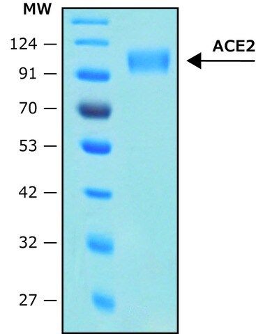 Angiotensin Converting Enzyme-2, ACE2