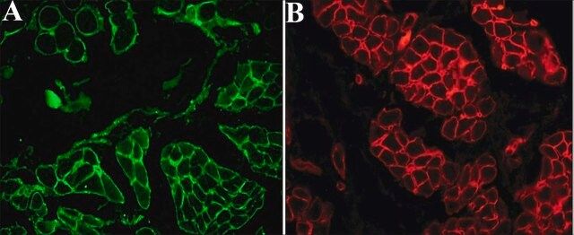 Anti-Laminin antibody, Mouse monoclonal