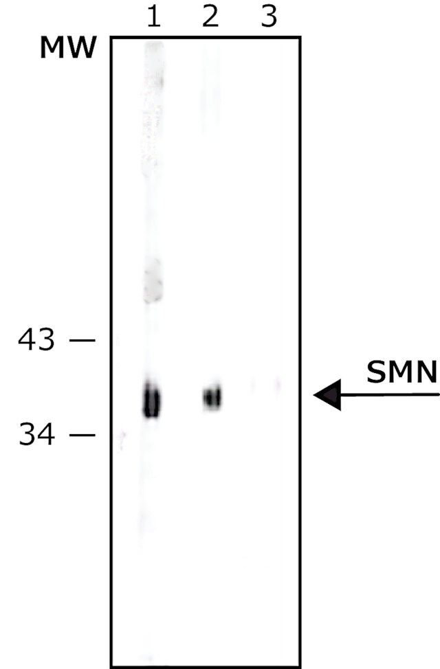 Anti-SMN antibody, Mouse monoclonal