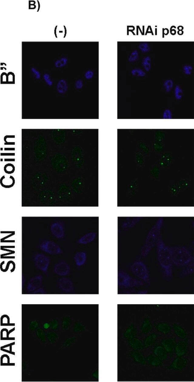 Anti-Coilin antibody, Mouse monoclonal antibody produced in mouse