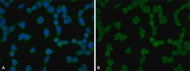 Anti-phospho-YAP1 (pTyr<sup>357</sup>) antibody produced in rabbit