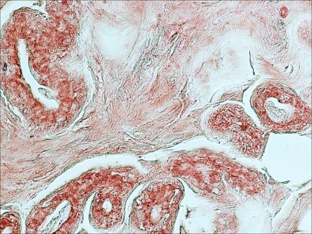 Monoclonal Anti-Cathepsin D antibody produced in mouse