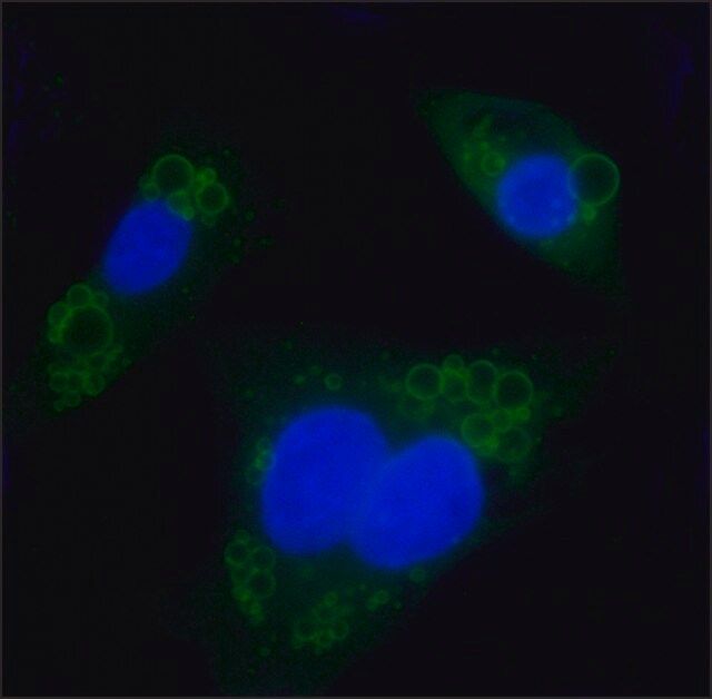 Anti-Perilipin A/B antibody produced in rabbit