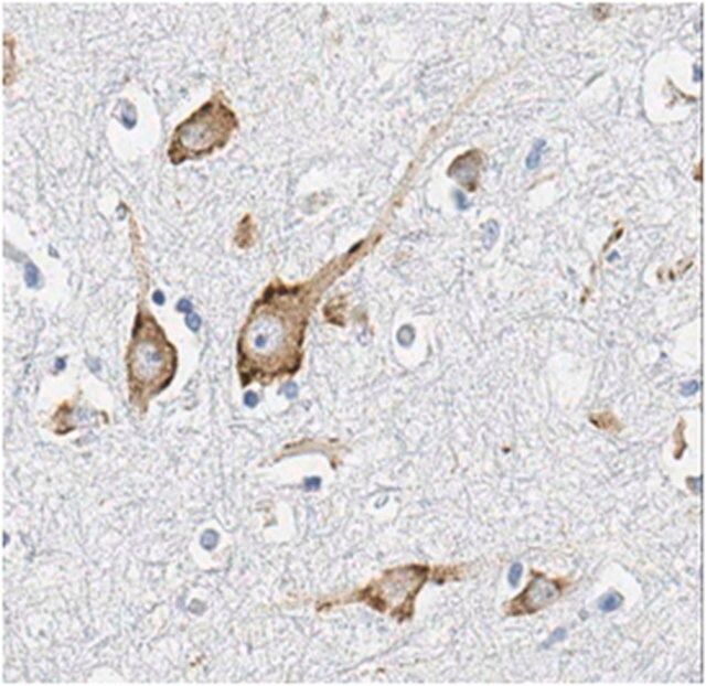 Anti-Potassium Channel KCNQ5 Antibody