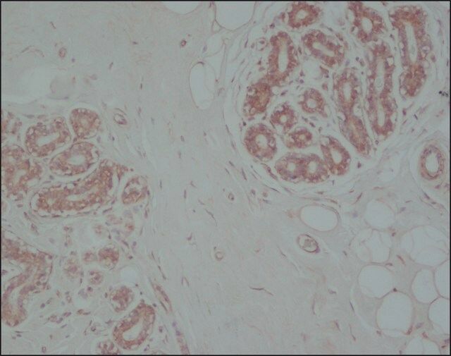 Anti-Vimentin antibody, Mouse monoclonal