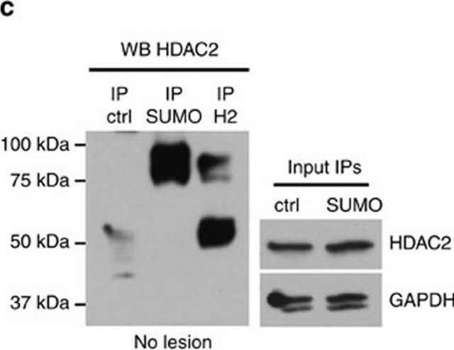 Anti-Histone Deacetylase 2 (HDAC2) antibody, Mouse monoclonal