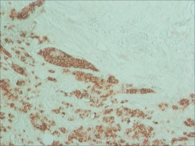 Monoclonal Anti-Episialin (EMA) antibody produced in mouse