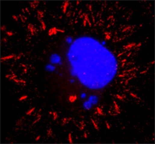 Anti-VSV Glycoprotein antibody, Mouse monoclonal