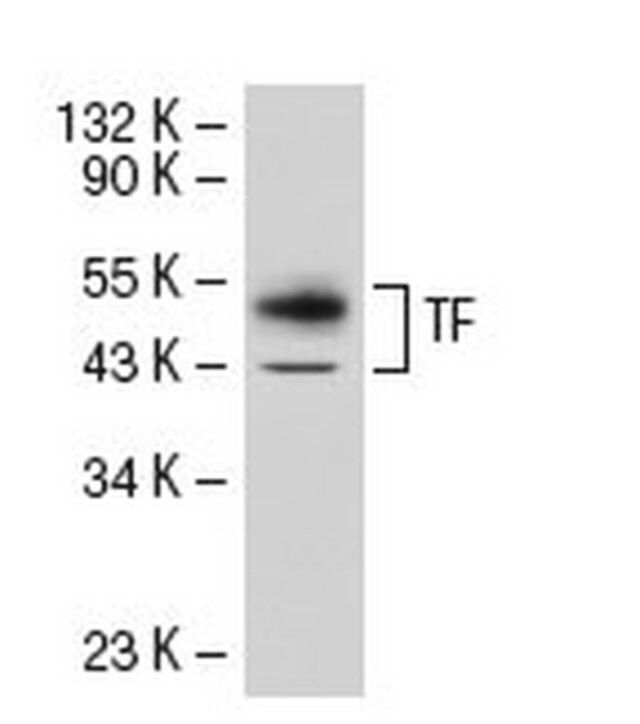 Anti-Tissue Factor Mouse mAb (TF9-10H10)