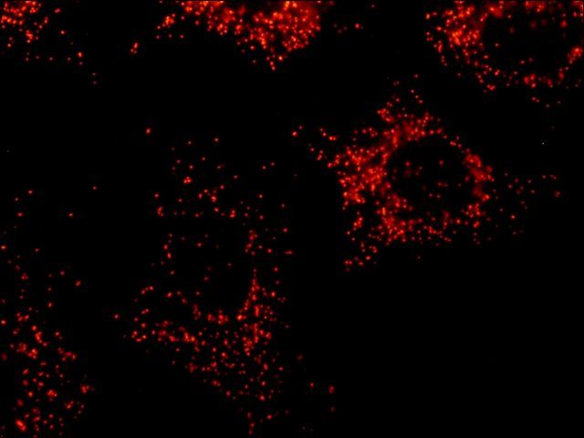 Anti-PMP70 antibody, Mouse monoclonal