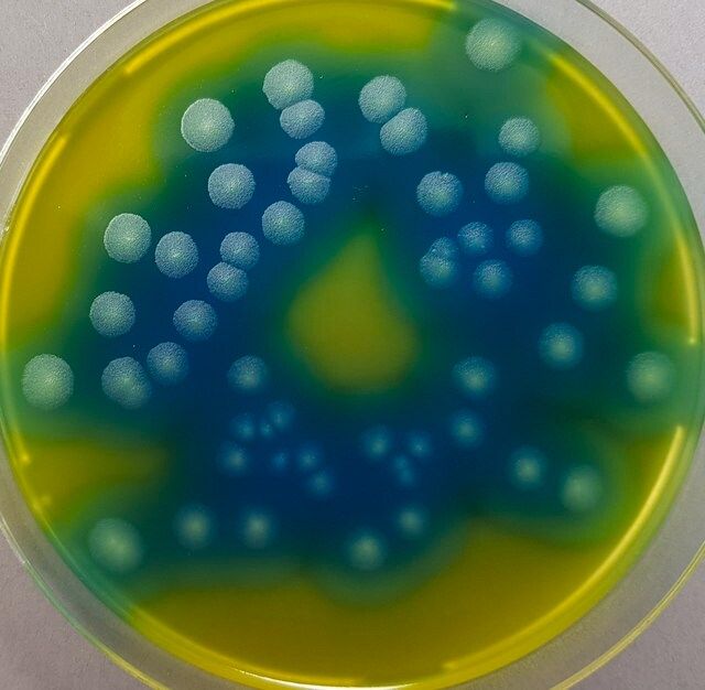 GranuCult<sup>®</sup> PEMBA (Polymyxin Pyruvate Egg yolk Mannitol Bromothymolblue Agar) (base)