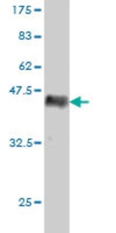 Monoclonal Anti-RAB15 antibody produced in mouse