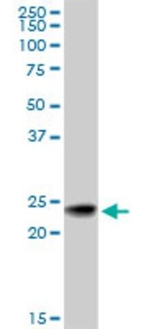 Monoclonal Anti-RAB7B antibody produced in mouse