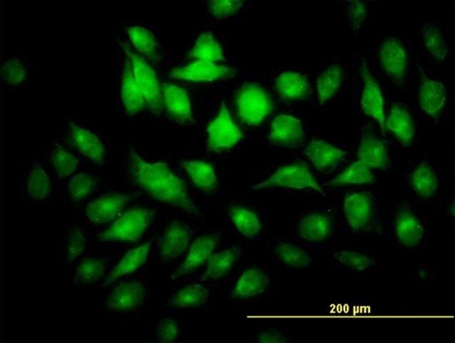 Monoclonal Anti-PYCRL antibody produced in mouse