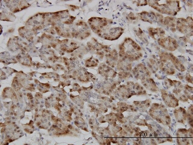 Monoclonal Anti-RANBP5 antibody produced in mouse