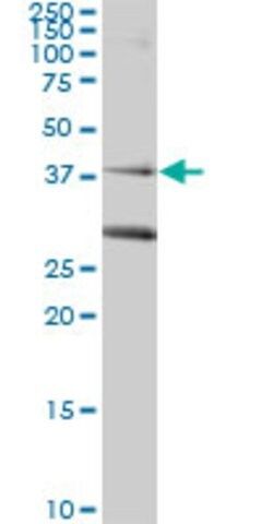 Monoclonal Anti-RAD51C antibody produced in mouse