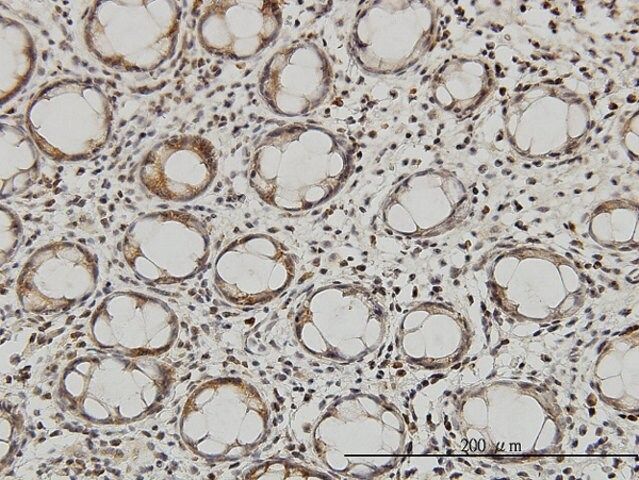 Monoclonal Anti-QARS antibody produced in mouse